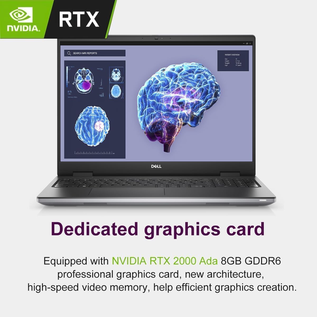 Dell Precision 7000 7780 Mobile Workstation Laptop, NVIDIA RTX 2000 Ada 8GB, 32GB LPCAMM2 DDR5 RAM, 17.3' FHD, Intel 24-Core i9-13950HX (>Ultra 7-165H), IST Computer Customized 1TB/2TB SSD, Win 11 Pro