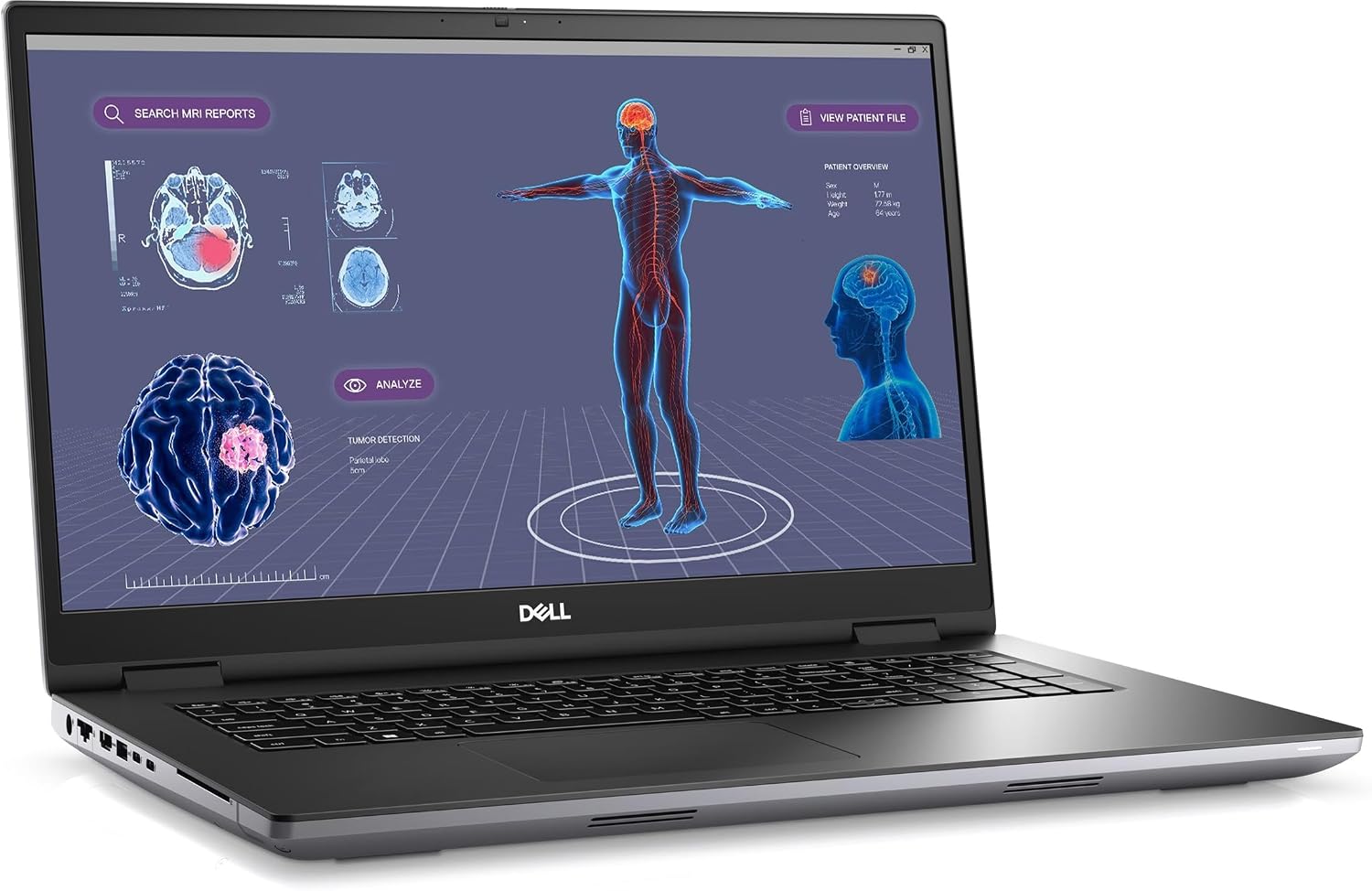Dell Precision 7000 7780 Mobile Workstation Laptop, NVIDIA RTX 2000 Ada 8GB, 32GB LPCAMM2 DDR5 RAM, 17.3' FHD, Intel 24-Core i9-13950HX (>Ultra 7-165H), IST Computer Customized 1TB/2TB SSD, Win 11 Pro